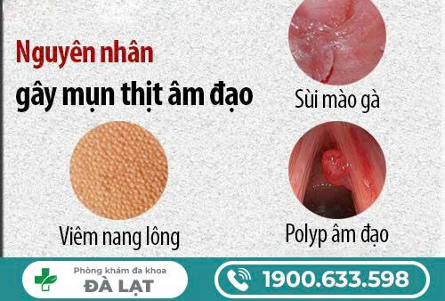 Hình ảnh minh họa